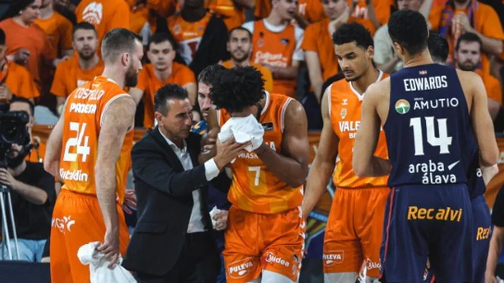 Así le fracturaron la nariz Braxton Key en pleno partido del Valencia Basket